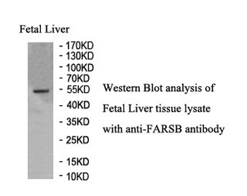 FARSB Rabbit Polyclonal Antibody