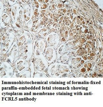 FCRL5 Rabbit Polyclonal Antibody