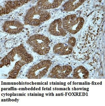 FOXRED1 Rabbit Polyclonal Antibody