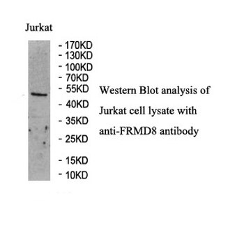 FRMD8 Rabbit Polyclonal Antibody