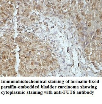 FUT6 Rabbit Polyclonal Antibody