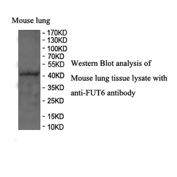 FUT6 Rabbit Polyclonal Antibody