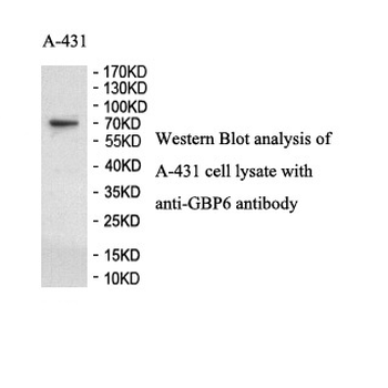 GBP6 Rabbit Polyclonal Antibody