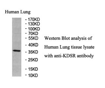 KDSR Rabbit Polyclonal Antibody