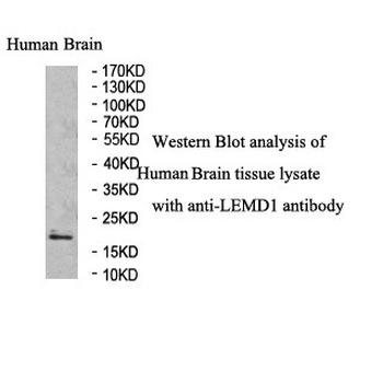 LEMD1 Rabbit Polyclonal Antibody