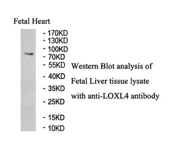 LOXL4 Rabbit Polyclonal Antibody