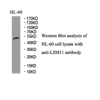 LSM11 Rabbit Polyclonal Antibody