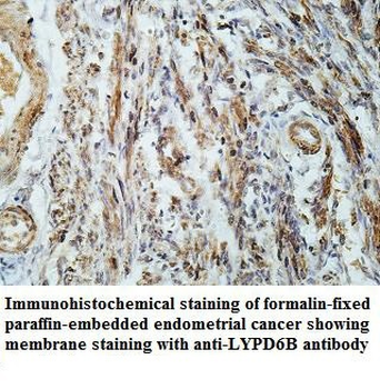 LYPD6B Rabbit Polyclonal Antibody