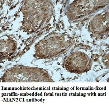 MAN2C1 Rabbit Polyclonal Antibody