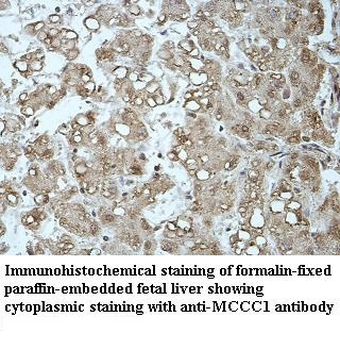 MCCC1 Rabbit Polyclonal Antibody