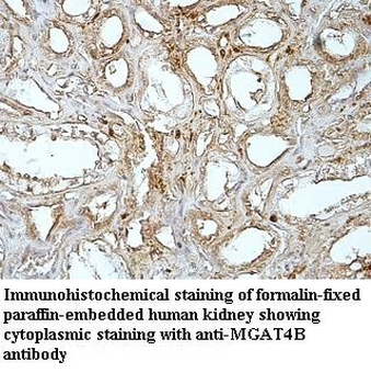 MGAT4B Rabbit Polyclonal Antibody