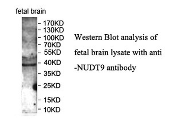 NUDT9 Rabbit Polyclonal Antibody