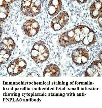 PNPLA6 Rabbit Polyclonal Antibody