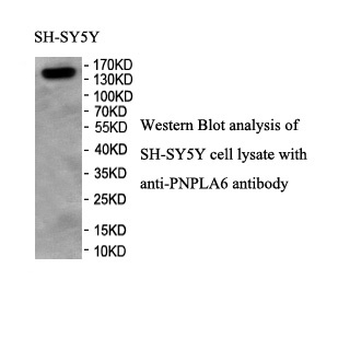 PNPLA6 Rabbit Polyclonal Antibody