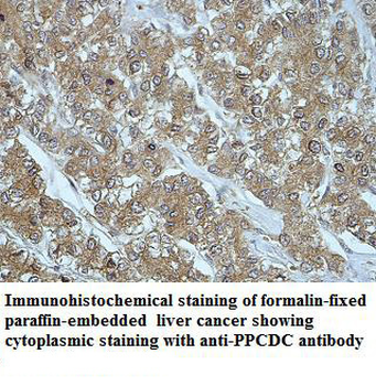 PPCDC Rabbit Polyclonal Antibody