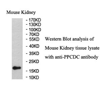 PPCDC Rabbit Polyclonal Antibody