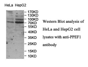 PPEF1 Rabbit Polyclonal Antibody