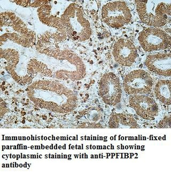 PPFIBP2 Rabbit Polyclonal Antibody