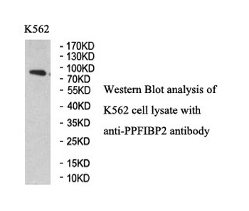PPFIBP2 Rabbit Polyclonal Antibody