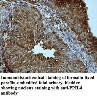 PPIL4 Rabbit Polyclonal Antibody