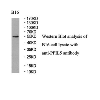 PPIL5 Rabbit Polyclonal Antibody