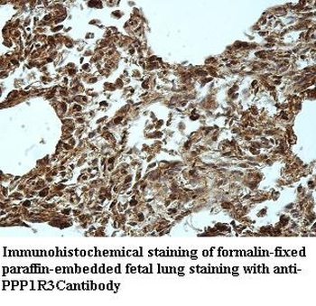 PPP1R3C Rabbit Polyclonal Antibody