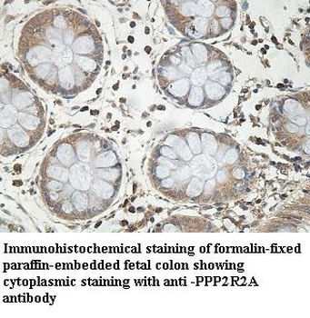 PPP2R2A Rabbit Polyclonal Antibody