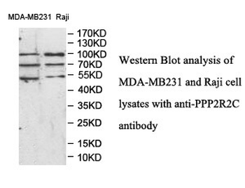 PPP2R2C Rabbit Polyclonal Antibody