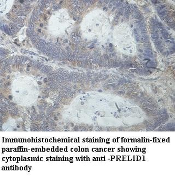 PRELID1 Rabbit Polyclonal Antibody