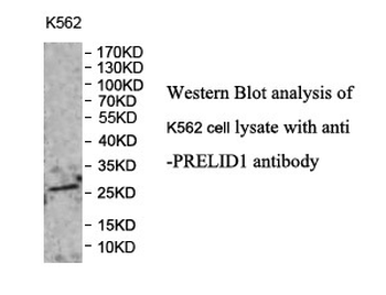 PRELID1 Rabbit Polyclonal Antibody