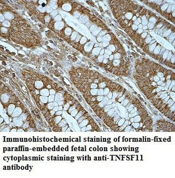 TNFSF11 Rabbit Polyclonal Antibody