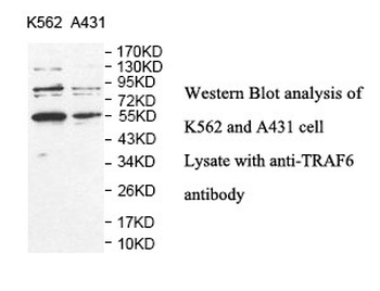 TRAF6 Rabbit Polyclonal Antibody