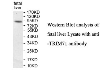 TRIM71 Rabbit Polyclonal Antibody