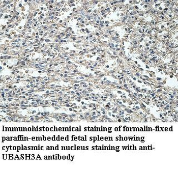 UBASH3A Rabbit Polyclonal Antibody