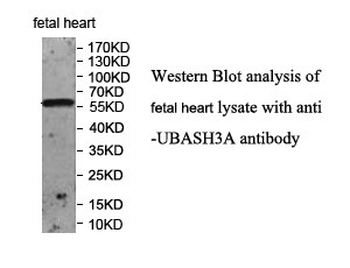 UBASH3A Rabbit Polyclonal Antibody