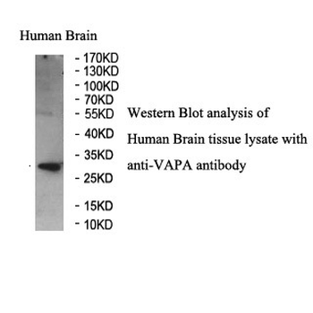 VAPA Rabbit Polyclonal Antibody