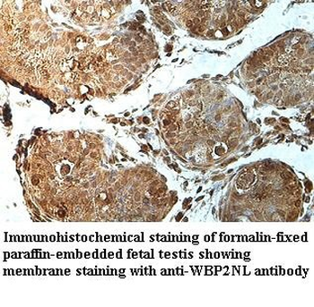 WBP2NL Rabbit Polyclonal Antibody