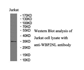 WBP2NL Rabbit Polyclonal Antibody