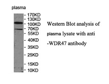 WDR47 Rabbit Polyclonal Antibody