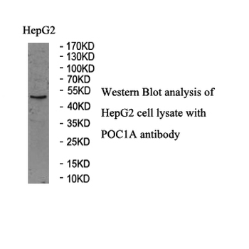 WDR51A Rabbit Polyclonal Antibody