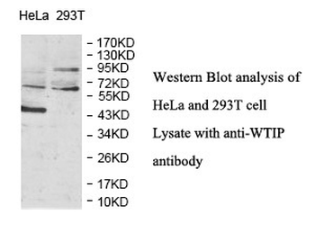 WTIP Rabbit Polyclonal Antibody