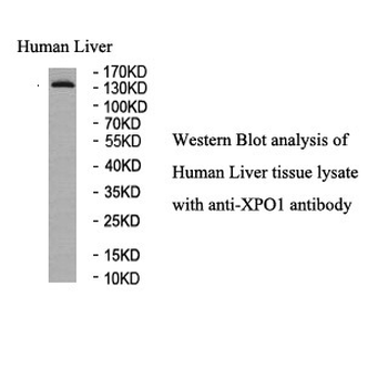 XPO1 Rabbit Polyclonal Antibody