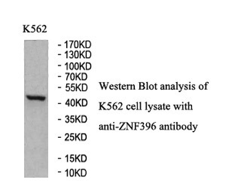 ZNF396 Rabbit Polyclonal Antibody