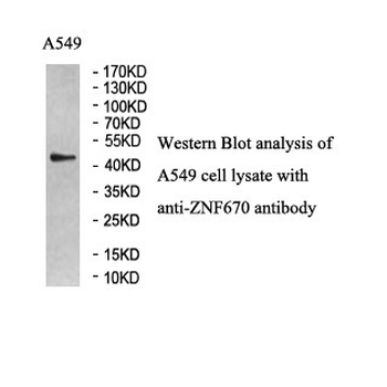 ZNF670 Rabbit Polyclonal Antibody