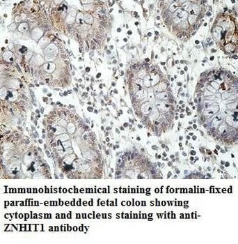 ZNHIT1 Rabbit Polyclonal Antibody