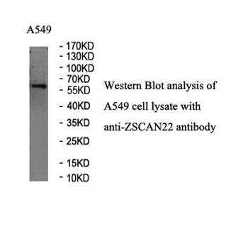 ZSCAN22 Rabbit Polyclonal Antibody