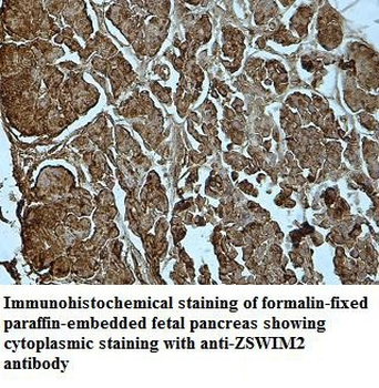 ZSWIM2 Rabbit Polyclonal Antibody