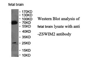 ZSWIM2 Rabbit Polyclonal Antibody
