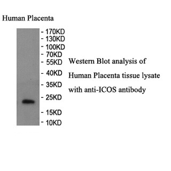 ICOS Rabbit Polyclonal Antibody