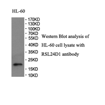 C15orf15 Rabbit Polyclonal Antibody